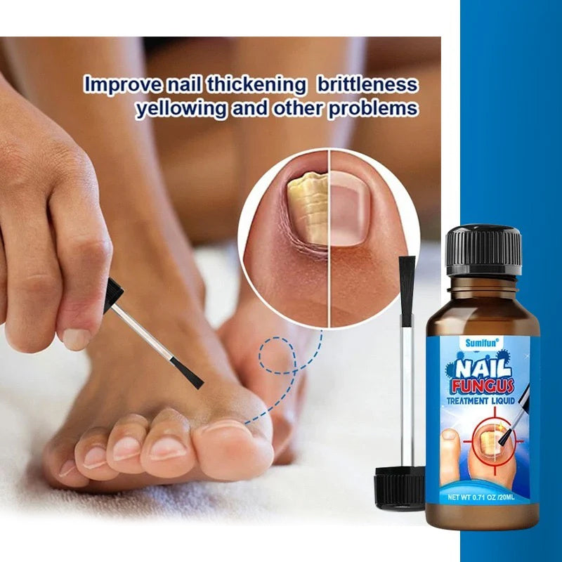 Sumifun - Nail Fungus Treatment Liquid (Original)